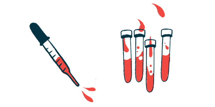 A squirting dropper is shown next to vials of blood.