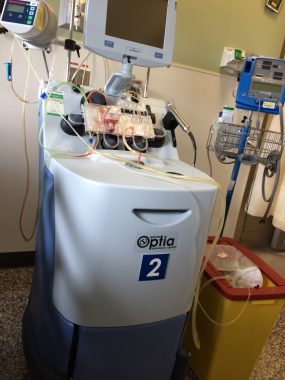 Optic neuritis | Neuromyelitis News | A plasma exchange machine in the hospital.