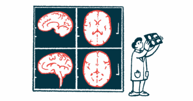 A doctor examines images of a brain taken from an MRI in front of wall-sized version of the images.