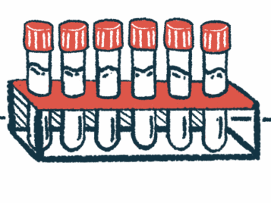 Six vials with caps on them are seen side by side in a rack.